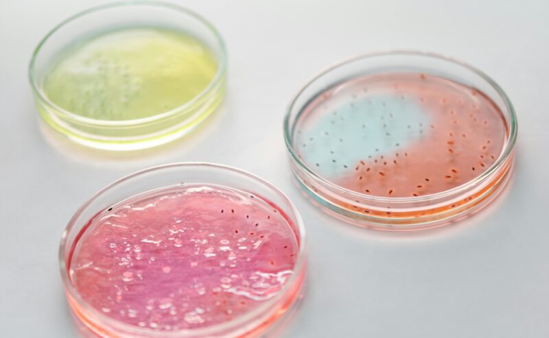 Listeria monocytogenes, nuovi criteri di sicurezza alimentare